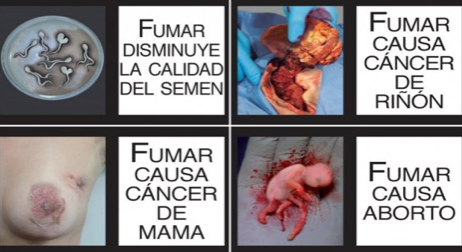 Con crudas imagenes minsalud busca reducir consumo de tabaco